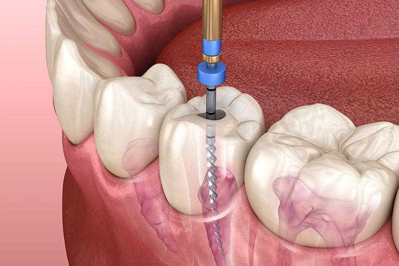 Oralis  MULTISPECIALITY DENTAL CLINIC