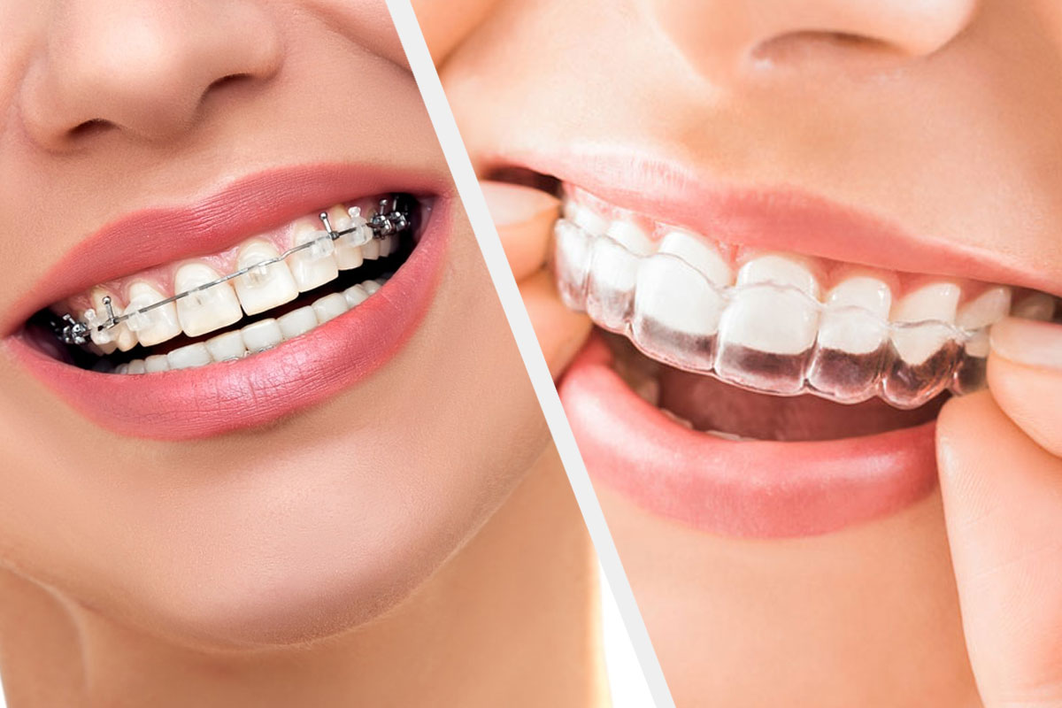Oralis  MULTISPECIALITY DENTAL CLINIC