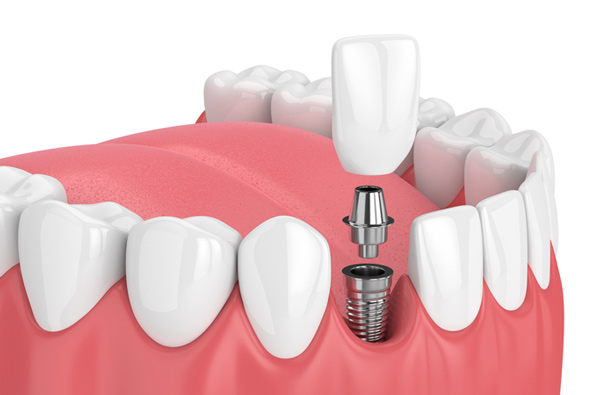 Oralis  MULTISPECIALITY DENTAL CLINIC
