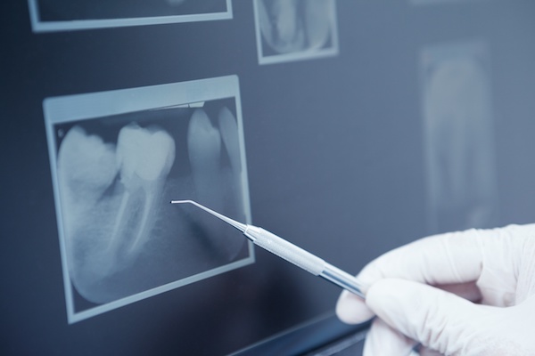 Oralis  MULTISPECIALITY DENTAL CLINIC